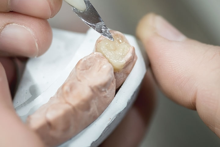 오늘의 치아성형